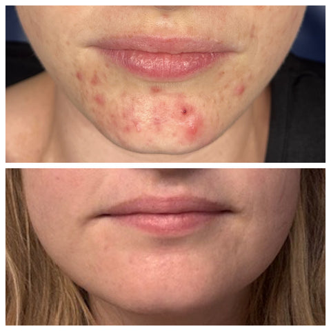 Translation missing: en.accessibility.image 2