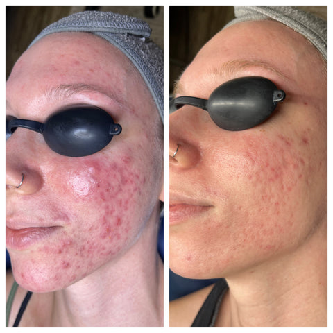 Translation missing: en.accessibility.image 1